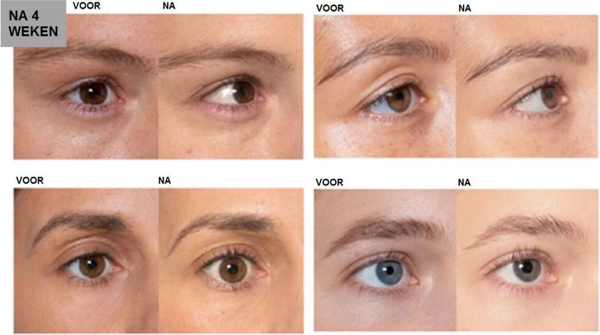 L'Oréal Paris Clinically Proven Wimperserum - 2 Ml - Afbeelding 5